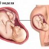 10 месяц беременности (37, 38, 39 и 40 недели беременности)